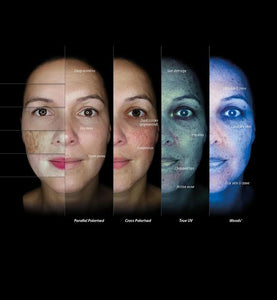 OBSERVE 520x Indepth  Skin Analysis - COMPLIMENTARY